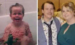 Benjamin Button Gerçek mi?