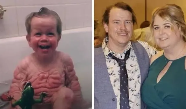Benjamin Button Gerçek mi?